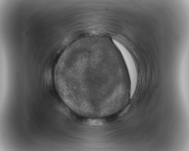 X0000085780520200704091414