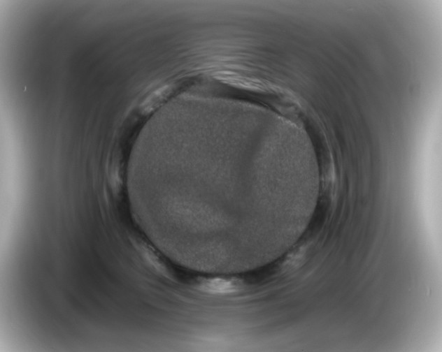 X0000085780566200704091414