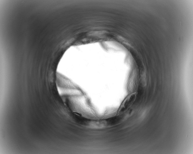 X0000085780571200704091414