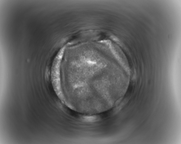 X0000085780669200704091413