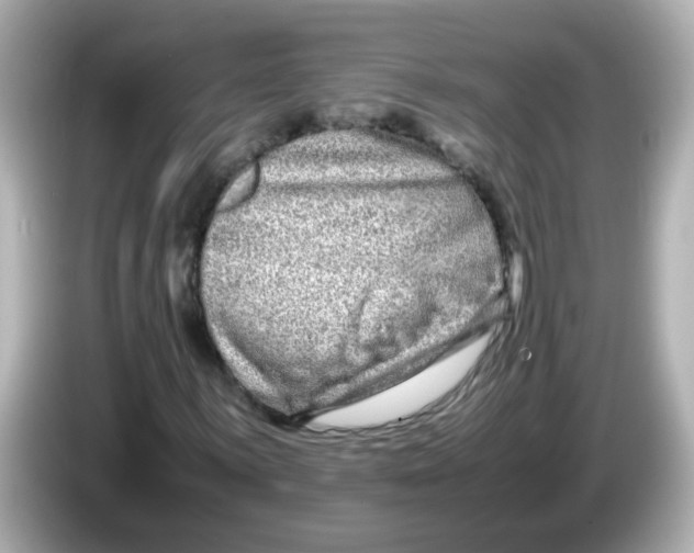 X0000085781059200704091408