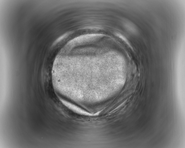 X0000085781064200704091407