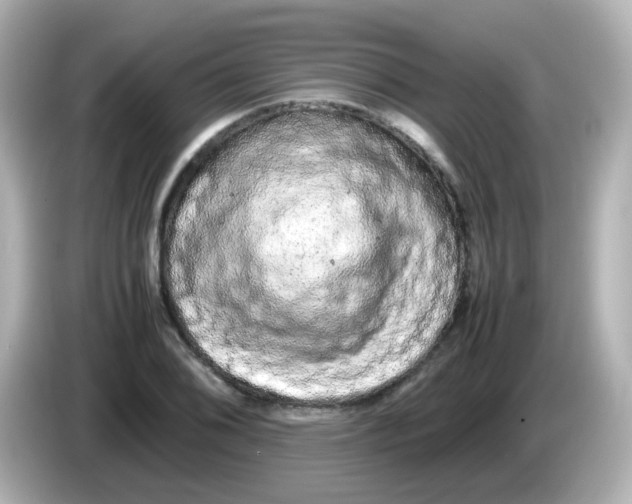 X0000085781076200704091407