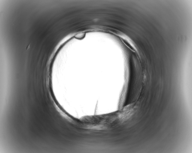 X0000085781143200704091407