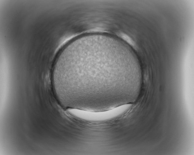 X0000085781356200704091404