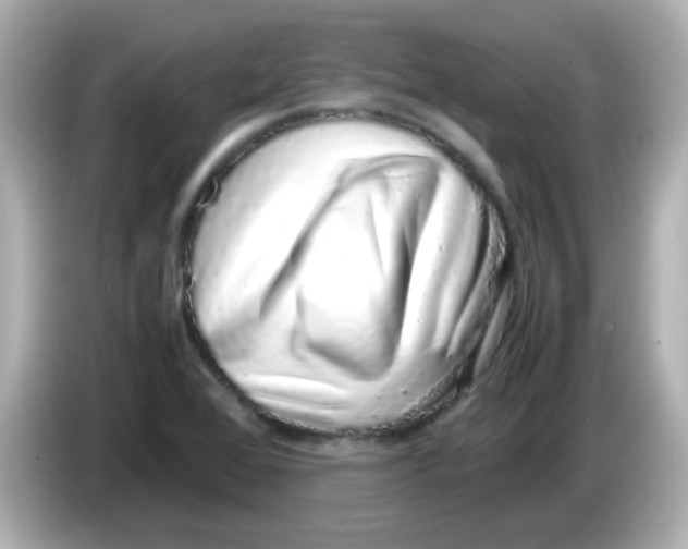 X0000085781368200704091404