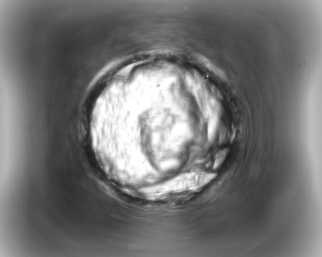 X0000085781400200704091403