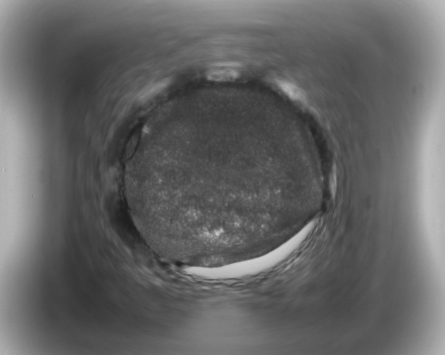 X0000085781445200704091403