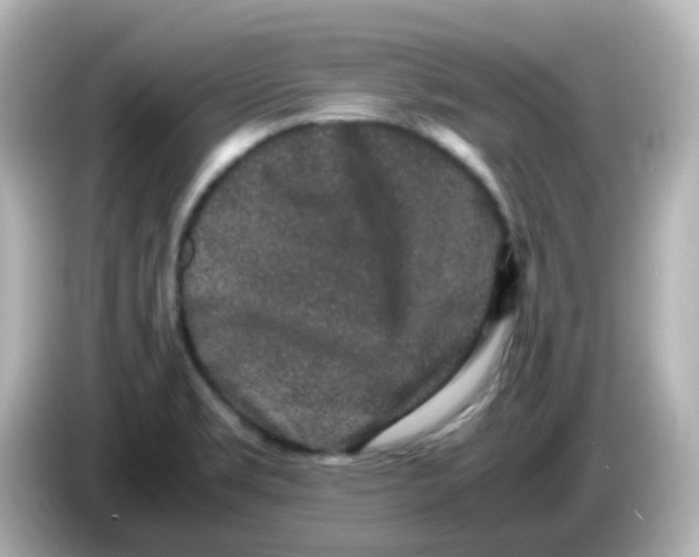 X0000085781469200704091403