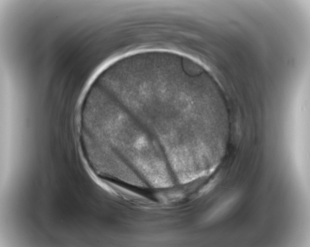 X0000085781519200704091402