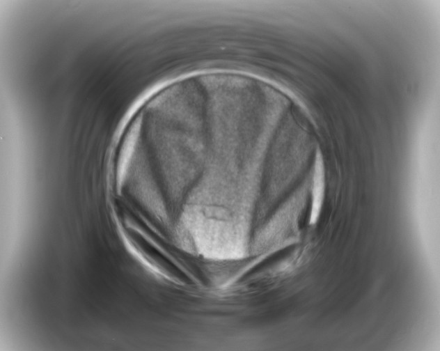 X0000085781527200704091402