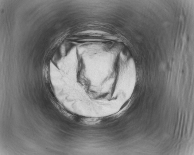 X0000085780094200704131840