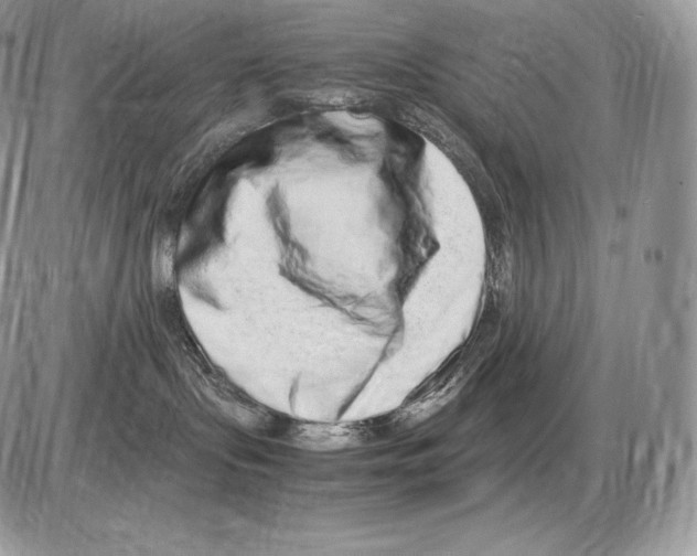 X0000085780095200704131840