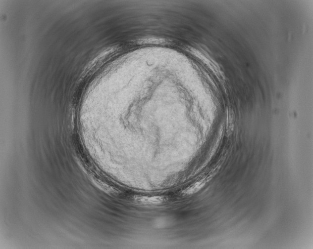 X0000085780157200704131838