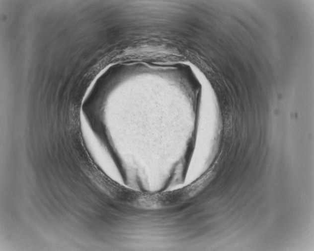 X0000085780178200704131838