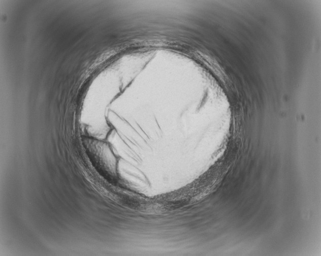 X0000085780301200704131836