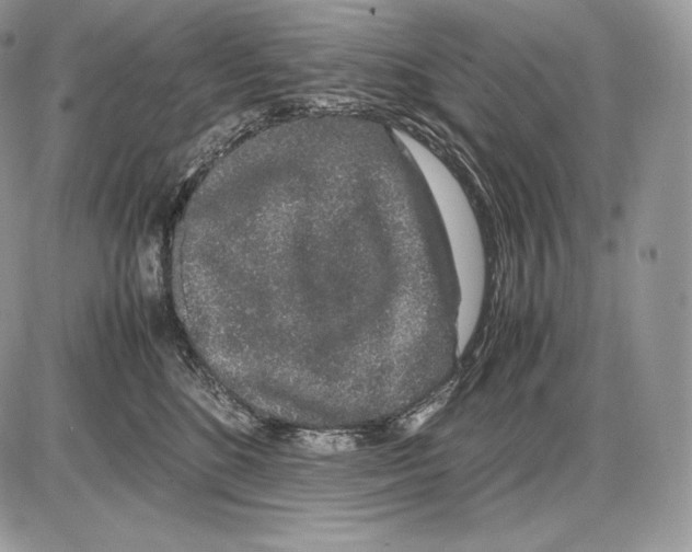 X0000085780520200704131832