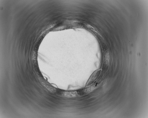 X0000085780571200704131832