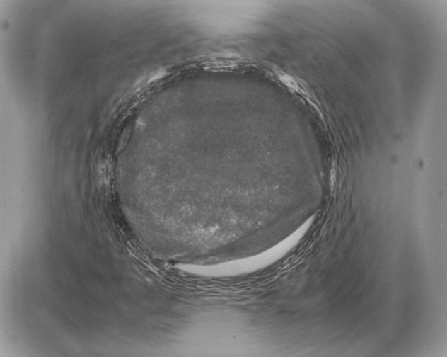 X0000085781445200704131817