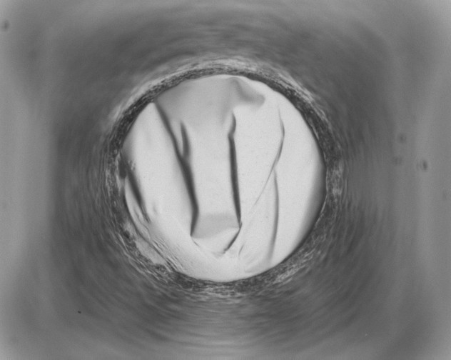 X0000085781496200704131815