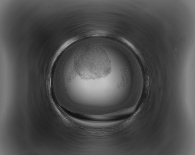 X0000085791418200703231258