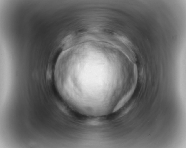 X0000085790072200704091438
