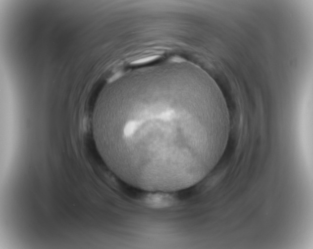 X0000085790137200704091437