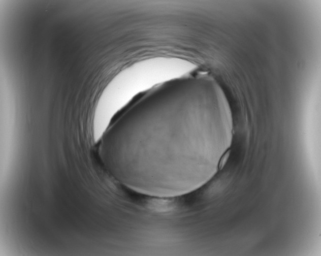 X0000085790139200704091437