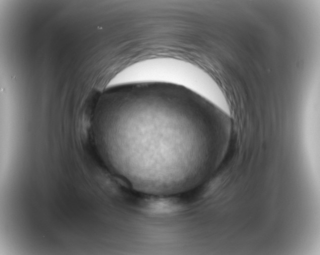 X0000085790235200704091436