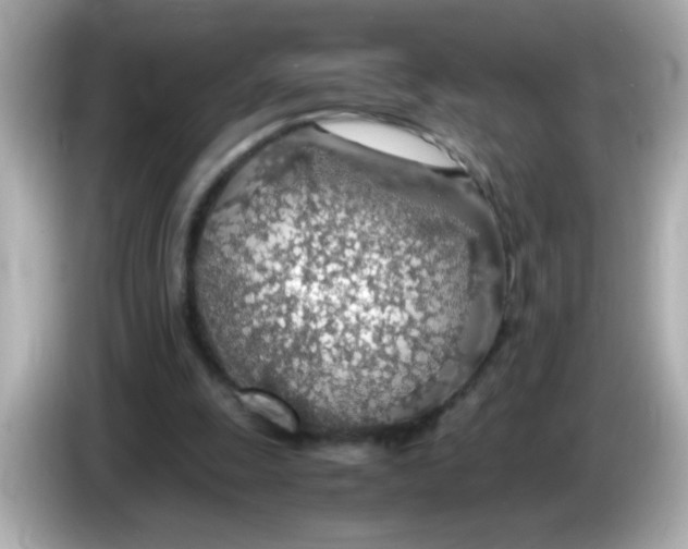 X0000085790247200704091435