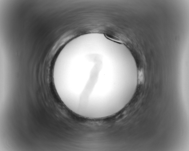 X0000085790291200704091435