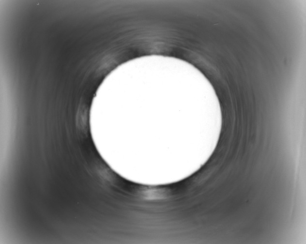 X0000085790336200704091435