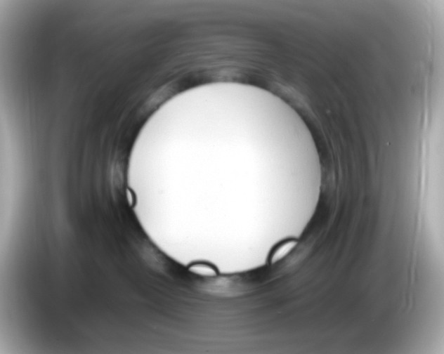 X0000085790382200704091435
