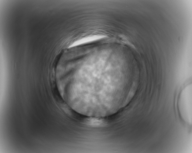 X0000085790528200704091432