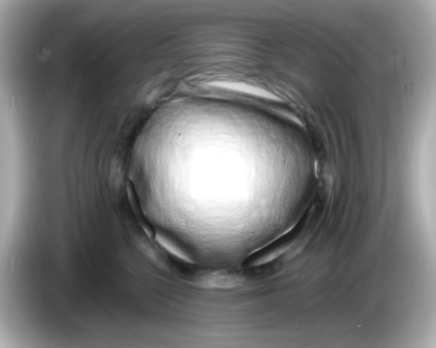 X0000085790568200704091432
