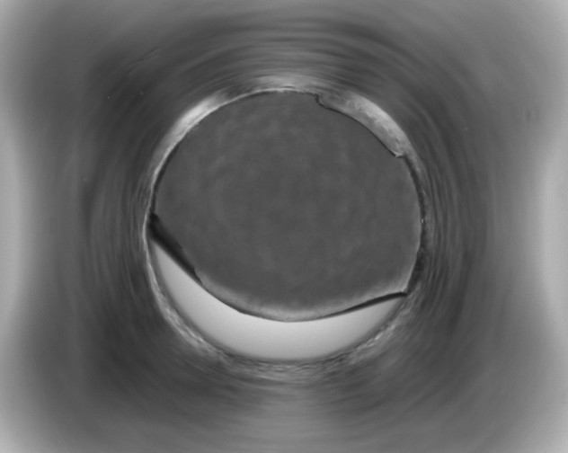 X0000085790946200704091428