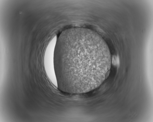 X0000085791155200704091425