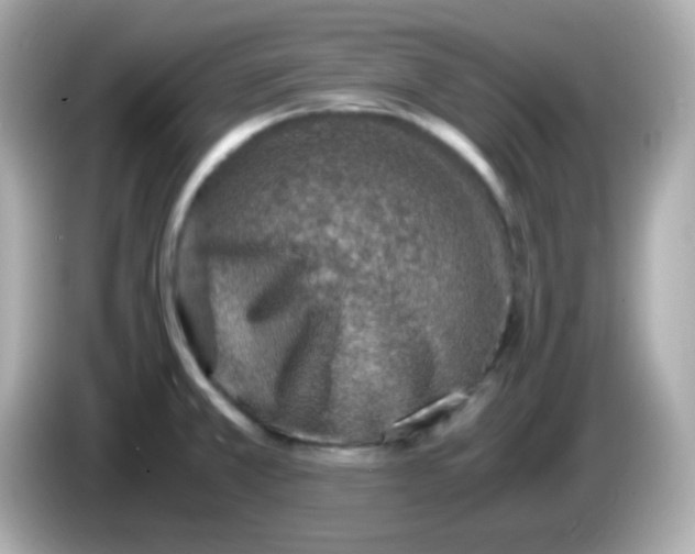 X0000085791381200704091422