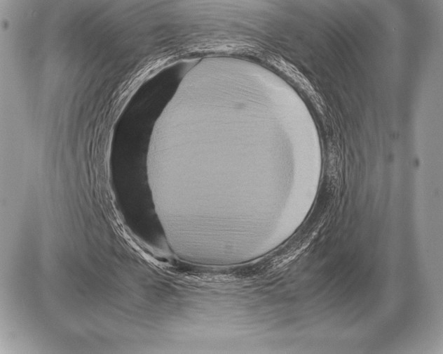 X0000085790577200704131857