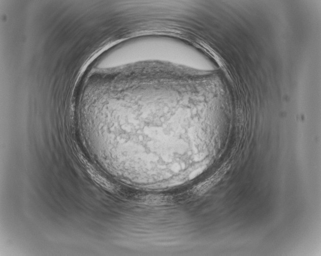 X0000085790779200704131853
