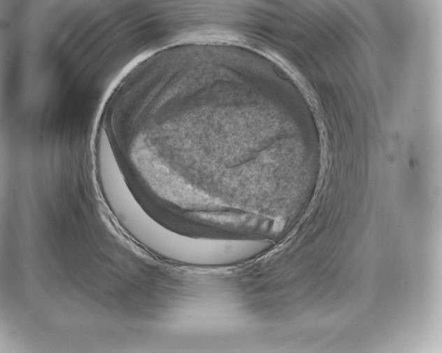 X0000085790864200704131853