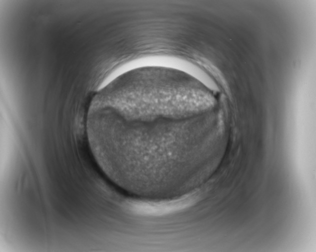 X0000085800017200704091457