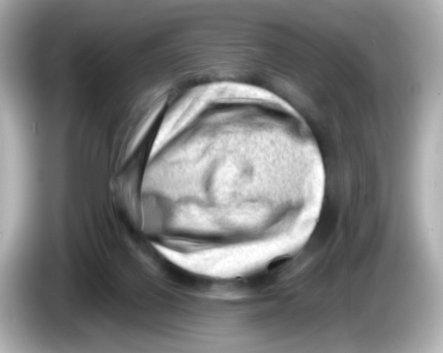 X0000085800070200704091456