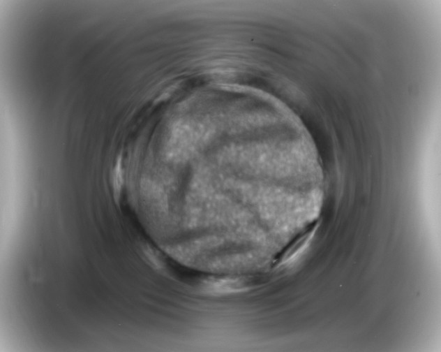 X0000085800186200704091455