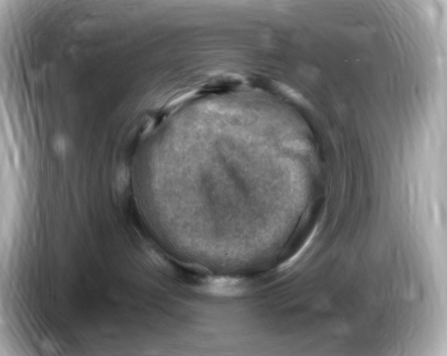 X0000085800192200704091455