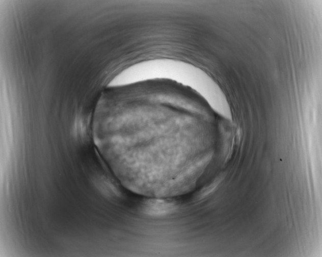 X0000085800239200704091454