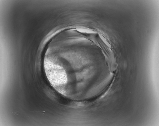 X0000085800295200704091454