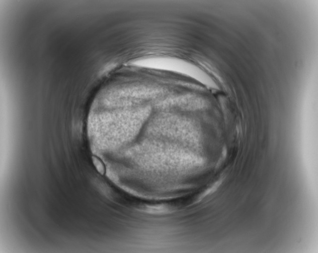 X0000085800309200704091453