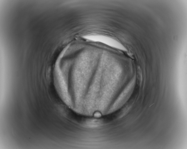 X0000085800319200704091453