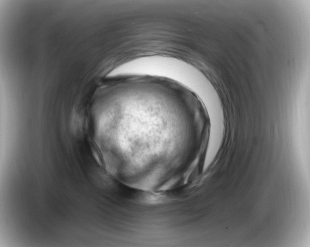 X0000085800333200704091453